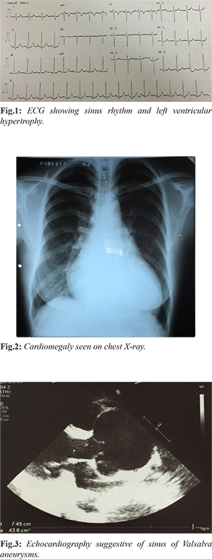 Acute Left Ventricular Systolic Dysfunction Following Device Closure of  Ruptured Sinus of Valsalva Aneurysm