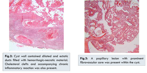 Papillomatosis and malignancy - Alexandru Nicolaescu - Google Scholar Citations