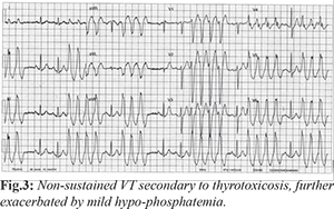 Cardiac electrophysiology pdf